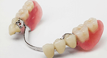 Как выбирать вид протезирования зубов