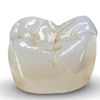 Несъемное протезирование зубов