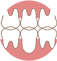 Клиновидный деффект: художественная реставрация зубов