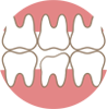 деформация зуба