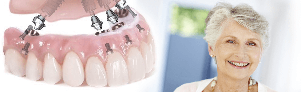 Зубные протезы и эстетика